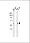 CSNK2A1 Antibody (Center)