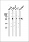 ADRA1D Antibody (N-term)