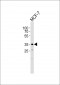 FBXL17 Isoform 2 Antibody (C-term)