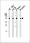 TUBA1C Antibody (N-term)