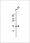 UBE2L6 Antibody (N-term)