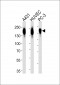 EGFR-S1026 Antibody (C-term)