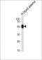 SERPINC1 Antibody (C-term)