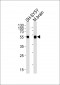 DAPK2 Antibody (N-term)