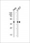 PGK1 Antibody (Center)