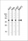 PGK1 Antibody (Center S320)