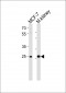 CA2 Antibody (N-term)