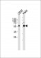 DYRK2 Antibody (N-term)