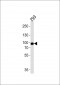PLA2G4A Antibody (Center)