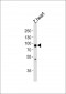 hsp90a.1 Antibody (Center)