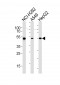 ALDH2 Antibody