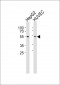 SUV39H2 Antibody (N-term)