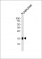 REG3A Antibody (C-term)