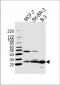FAM216B Antibody (C-term)