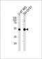 NSE Antibody