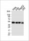 NSE Antibody