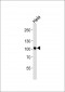 NF-KB p100 Antibody (Ab-869)