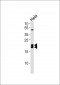 Caveolin-1 Antibody