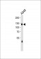 EPHA2/3/4 Antibody (Ab-588/596) 