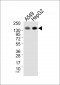 EGFR  Antibody (Ab-1172)