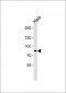 PKCD Antibody (Ab-64)