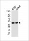 Mnk1 Antibody  (Ab-385)