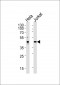 AVPR2 Antibody