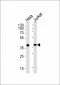 PAR4 Antibody