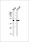 PTGDR Antibody