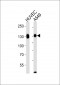 ITGAV (heavy chain, Cleaved-Lys889) Antibody