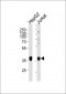 MTR1B Antibody