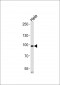 ADD1 (Ab-726) Antibody