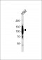 mGluR6 Antibody