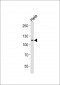 BUB1B Antibody