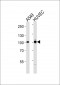 ADCY9 Antibody