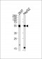 PHKG1 Antibody