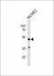 Prostacyclin Receptor Antibody