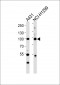 FA13A (Cleaved-Gly39) Antibody