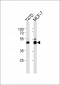 RAD23B Antibody