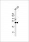 RAB6A Antibody