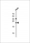 UBE2T Antibody