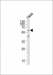 TRXR2 Antibody