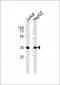 PDLIM1 Antibody