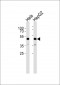 DAPK3 Antibody  (Ab-265) 