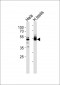 TTF2 Antibody