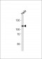 HGS Antibody