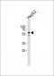 Activin Receptor Type IA (ACVR1) Antibody (Center R147)