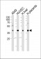 OLR1 Antibody (Center)