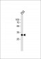 RPS6 Antibody (N-term)