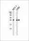 CDKN1B Antibody